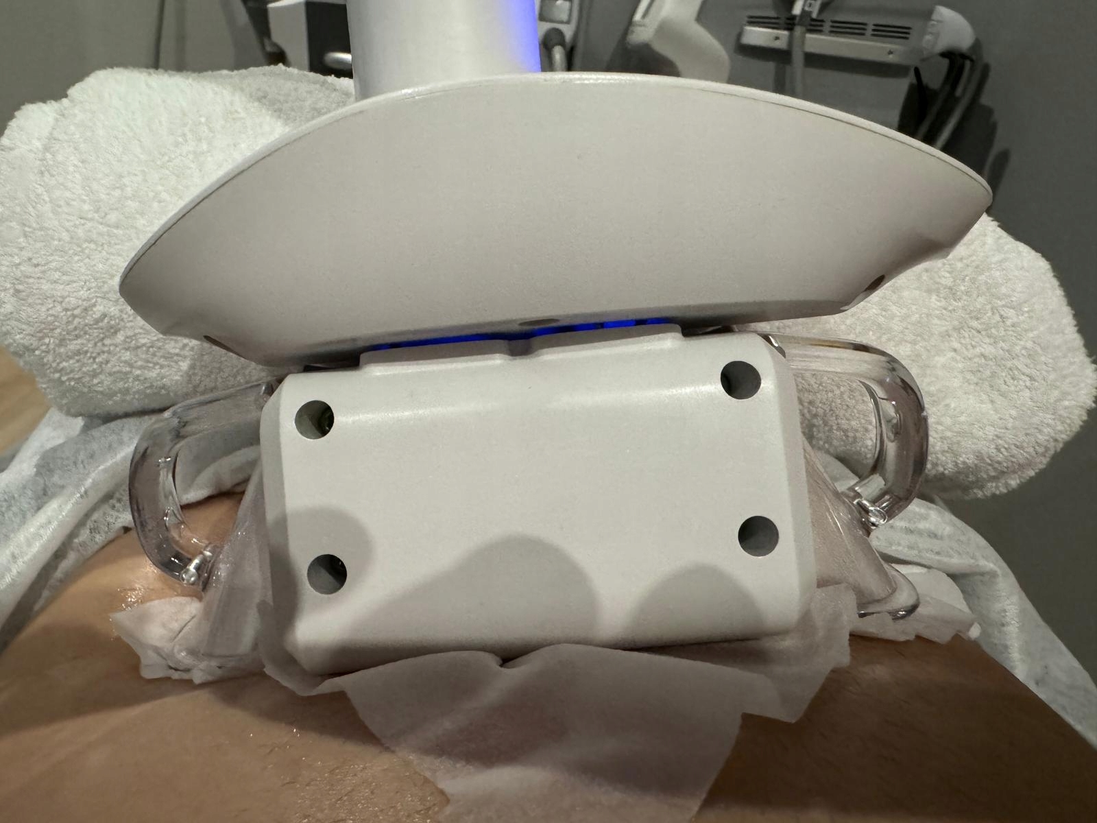 MEMBRANA DO KRIOLIPOLIZY