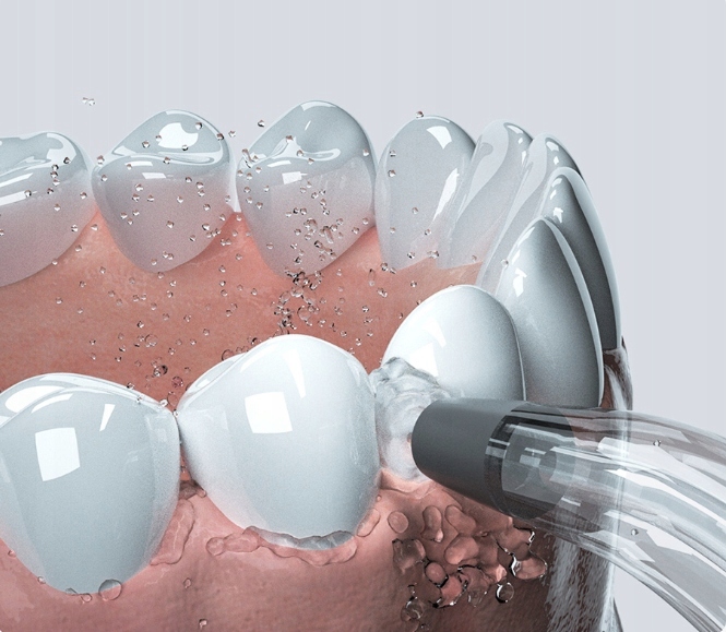 Bezprzewodowy Irygator Dentystyczny Oclean W1