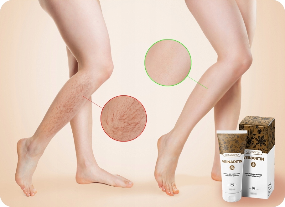 3x Veinaritin - wsparcie ociężałych nóg, usuwanie żylaków i pajączków