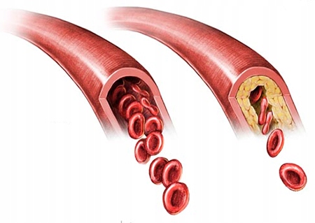 3x CHOLESTEROL FORTE 135kaps BERGAMOTA PROTON LABS