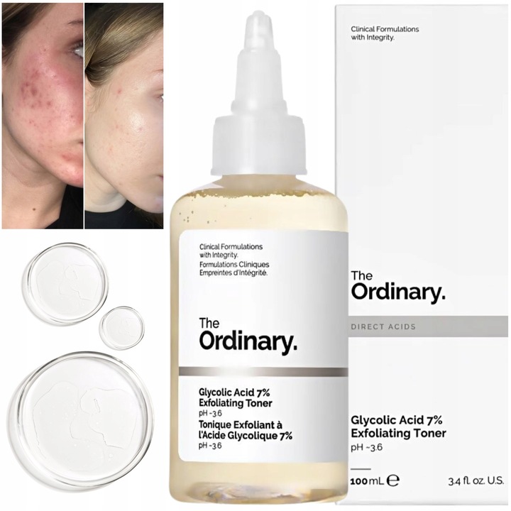 The Ordinary Tonik do Twarzy Glycolic Acid 7% Peeling Glikolowy 240 ml
