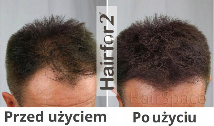 HairFor2 100ml Mikrowłókna w Sprayu do Zagęszczania Włosów