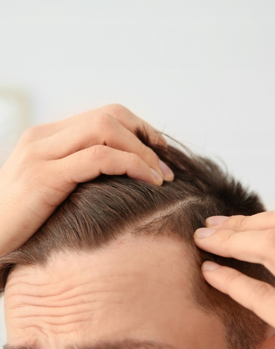 Szampon dla mężczyzn przeciw wypadaniu włosów Seboradin MEN 400 ml