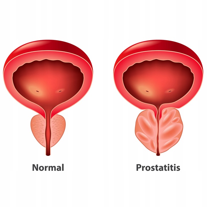 PROTON LABS Prostanol Forte - palma sabałowa na prostatę