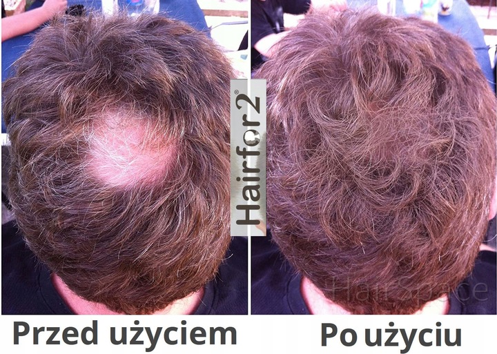 HairFor2 100ml Mikrowłókna w Sprayu do Zagęszczania Włosów