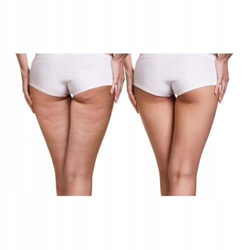 MASAŻER RĘCZNY DO MASAŻU STÓP CELLULIT STOP BÓL