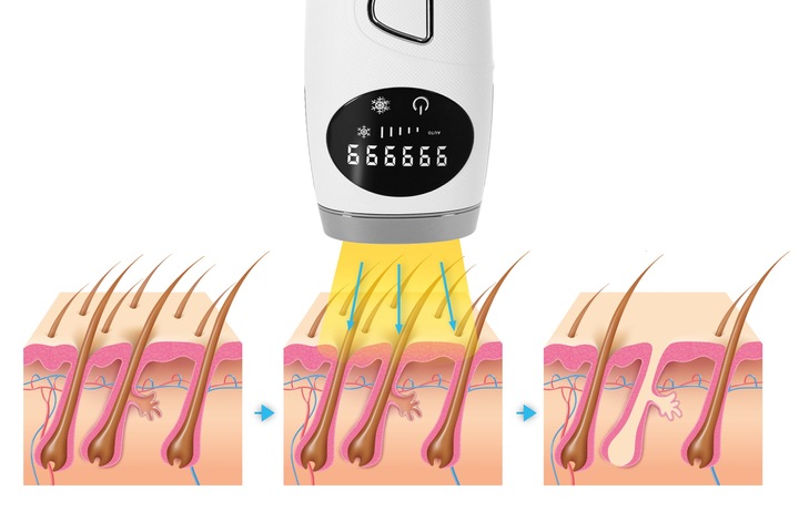 Depilator IPL Krexus Pro ICE COOL Ciało Bikini