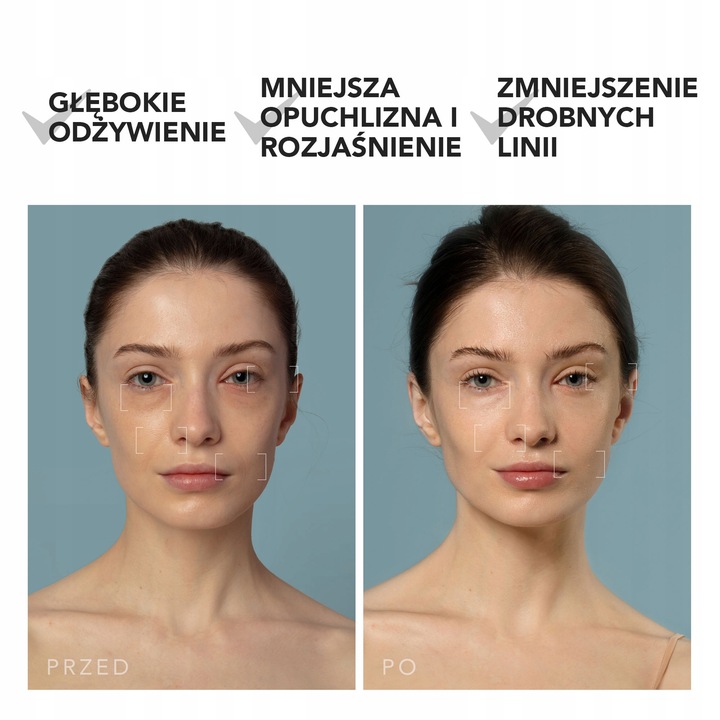 Głęboki nawilżacz do twarzy UFO 3, Czarny