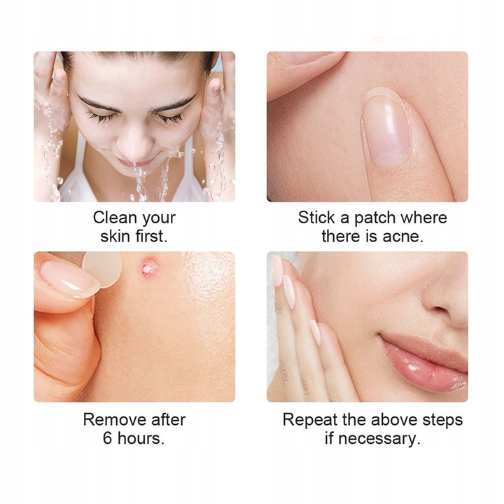 Plastry hydrokoloidowe na wypryski pryszcze 72 szt