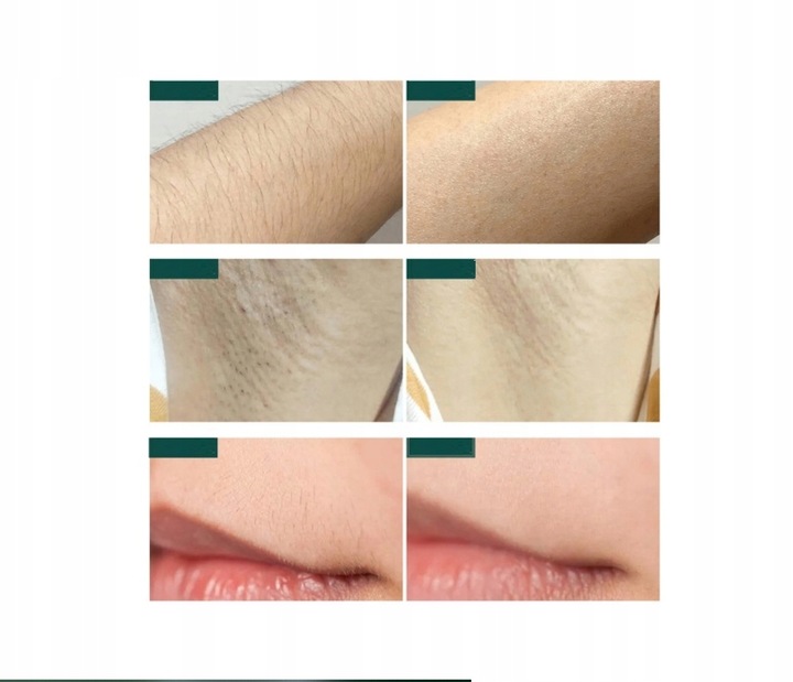 DEPILATOR IPL DO WŁOSÓW CIAŁA LASEROWY BIKINI NÓG DEPILACJA BEZBOLESNY