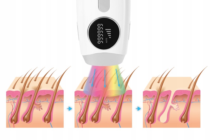 Depilator IPL Krexus Ciało Bikini PRO 5 trybów