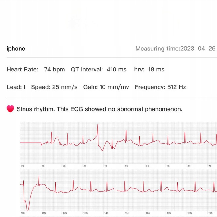 SMARTWATCH ZEGAREK MĘSKI GLUKOZA POMIAR CUKRU EKG CIŚNIENIE MENU POLSKIE