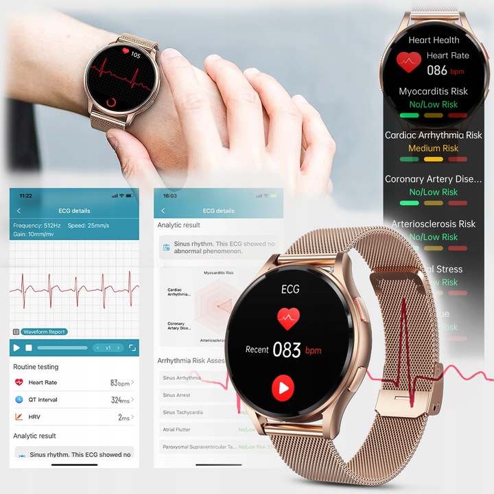 SMARTWATCH DAMSKI AMOLED KARDIOWATCH POMIAR EKG HRV CIŚNIENIE ROZMOWY SMS