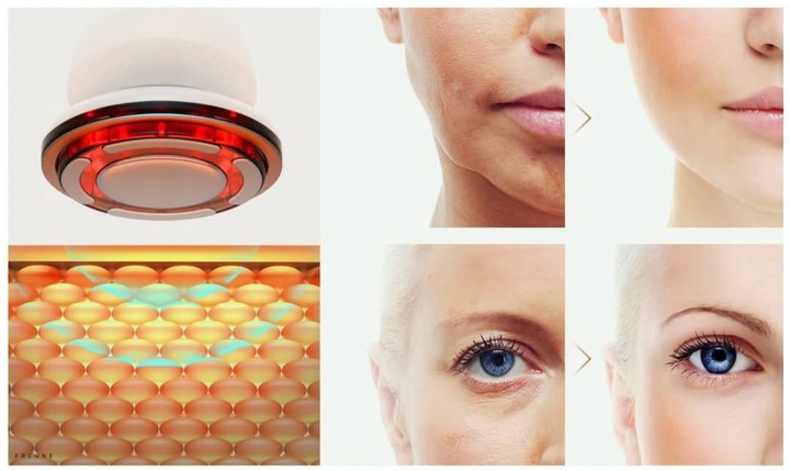 MEZOTERAPIA BEZIGŁOWA MASAŻER EMS TWARZY LIFTING 8W1 FRENNE ZESTAW + GRATIS