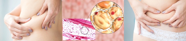 ELEKTROSTYMULATOR TENS EMS ELEKTRODY 3 RODZAJE+BAT
