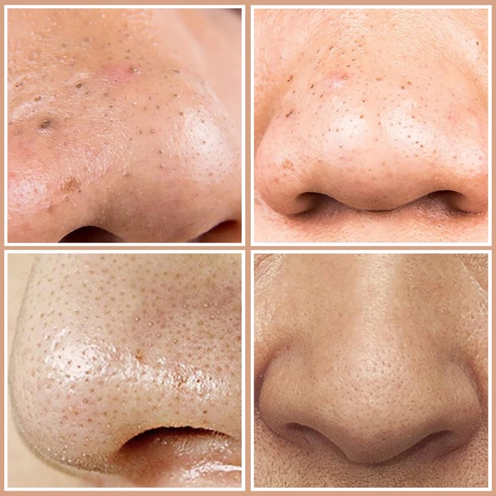 BIAŁA MASKA PILATEN WĄGRY + 60 PLASTRÓW