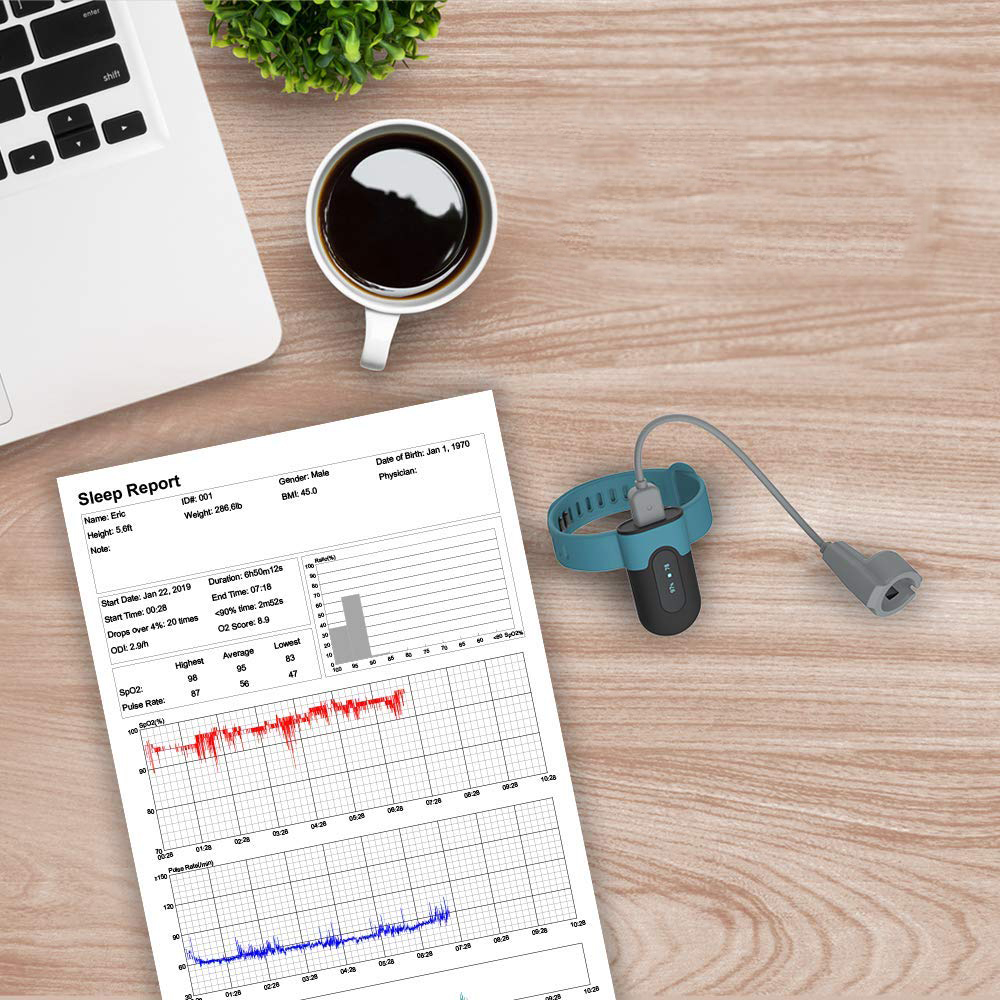 Pulsoksymetr ViATOM SleepU dla Androida i iOS z aplikacją