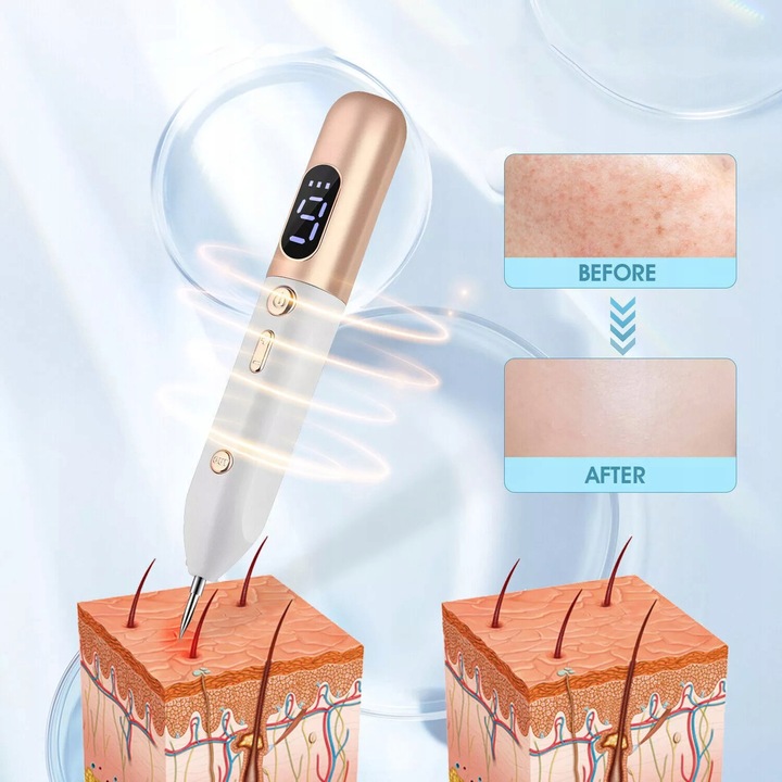 PIÓRO DO LASER USUWANIA ZNAMION PLAZMOWE DO USUWANIA BRODAWEK PIEPRZYK