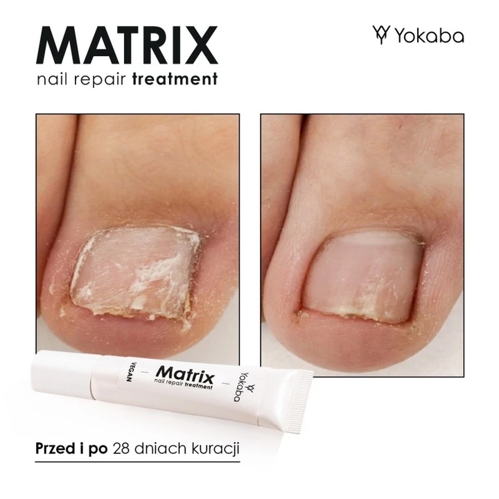 Yokaba MATRIX Preparat do regeneracji macierzy paznokcia 15 ml
