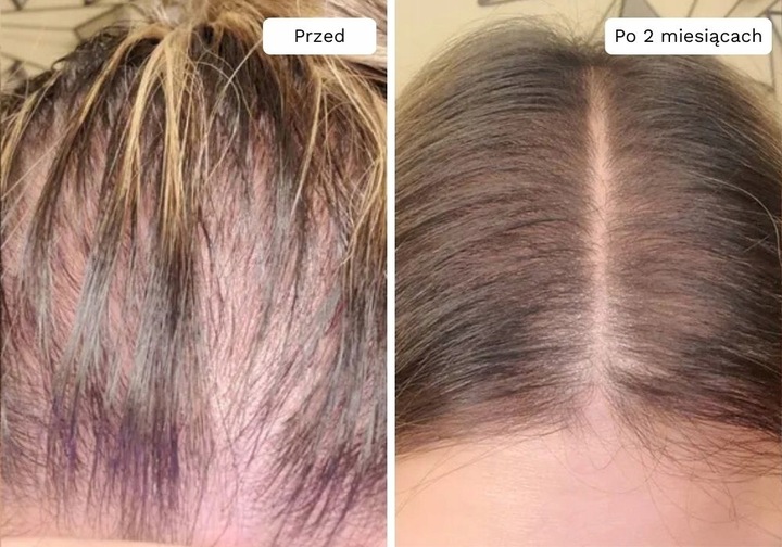 Wcierka Serum na porost i wypadanie włosów wzmacnia cebulki - Lavress 10w1