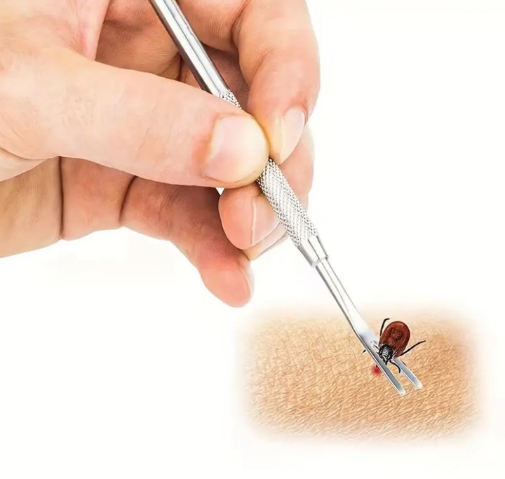 SZCZYPCE PĘSETA DO USUWANIA WYCIĄGANIA KLESZCZY DLA PSA KOTA LUDZI ZESTAW