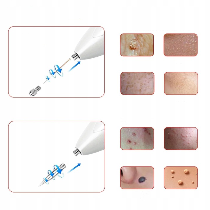 Laser Pen Plazma usuwanie tatuażu, blizn,brodawek 9 regulowanych poziomów