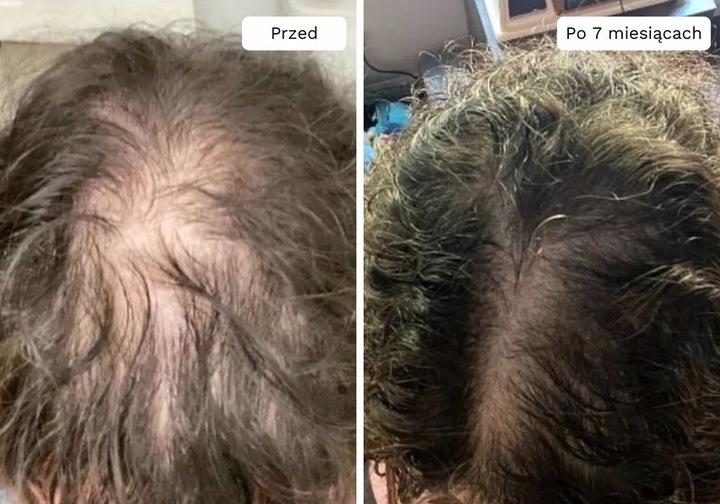 Wcierka Serum na porost i wypadanie włosów wzmacnia cebulki - Lavress 10w1