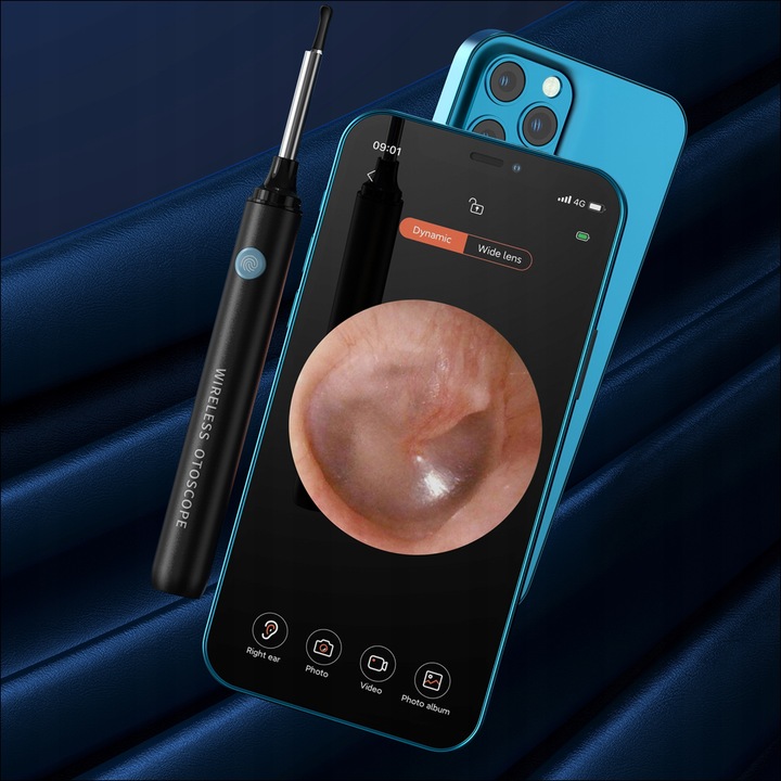 SMART OTOSKOP Z KAMERKĄ WIFI DO CZYSZCZENIA USZU NARZĘDZIA ZESTAW ENDOSKOP