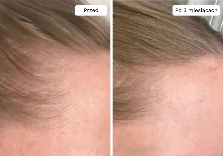 Wcierka Serum na porost i wypadanie włosów wzmacnia cebulki - Lavress 10w1