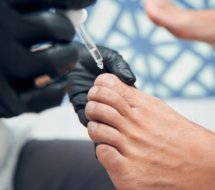 Arkada Serum TC16 Kolagenowe do Paznokci i Skóry Onycholiza 11ml