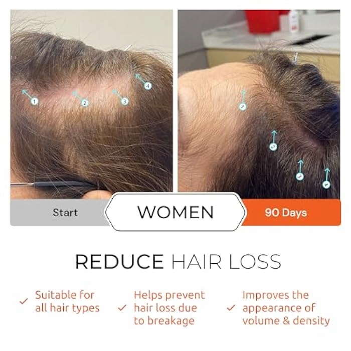 Spectral DNC-N z NANOXIDIL stymuluje porost włosów, powstrzymuje wypadanie