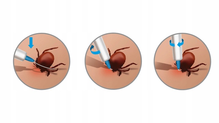 Lasso TRIX usuwanie kleszczy dla ludzi i zwierząt przyrząd do usuwania