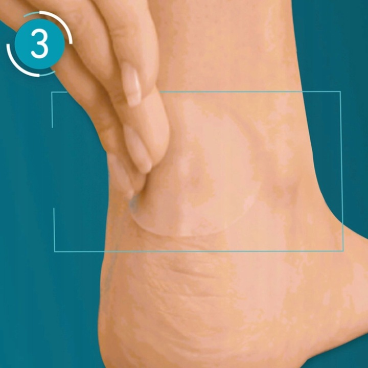 COMPEED Plastry na pęcherze średnie 5 szt.