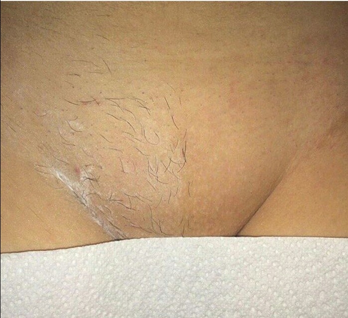 Pasta Cukrowa do depilacji + Paski + Puder lepszy chwyt MNIEJ BÓLU