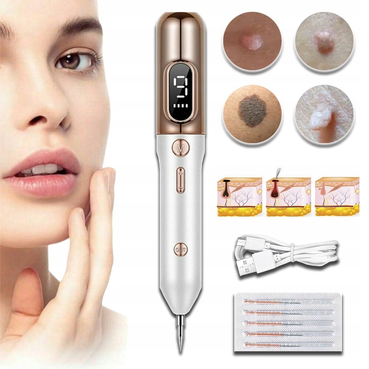 PIÓRO DO LASER USUWANIA ZNAMION PLAZMOWE DO USUWANIA BRODAWEK PIEPRZYK