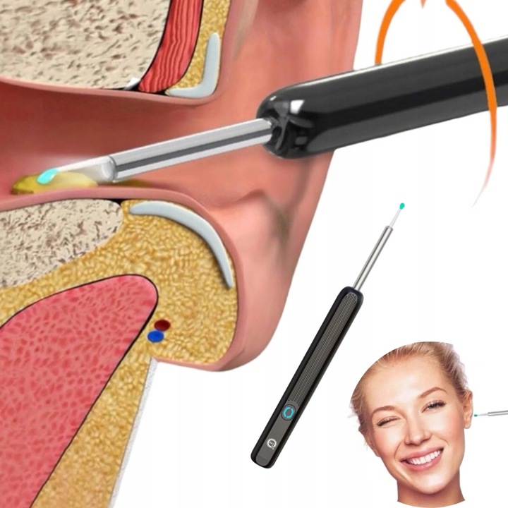 SMART OTOSKOP KAMERA CZYSZCZENIE USZU WOSK WIFI HD APLIKACJA ENDOSKOP