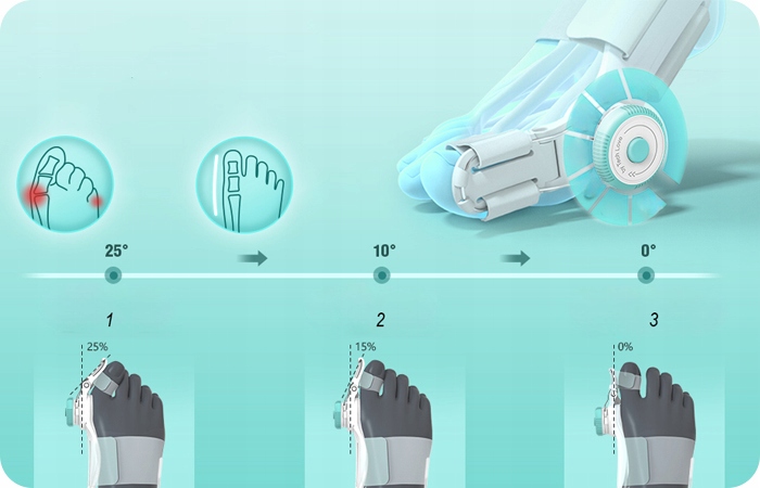 Separator na haluksy Korektor na haluksy od Herz Medical Instruments