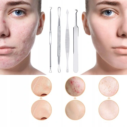 ZESTAW ŁYŻECZKI UNY DO USUWANIA WĄGRÓW ZASKÓRNIKÓW NARZĘDZIA DWUSTRONE ETUI