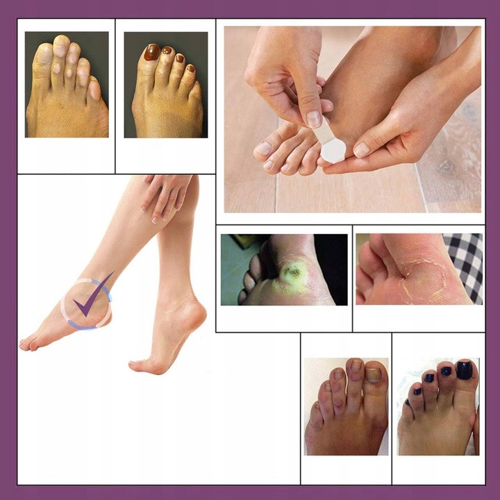 42 SZT. PLASTRY DO USUWANIA BRODAWEK ZESTAW DO BRODAWEK