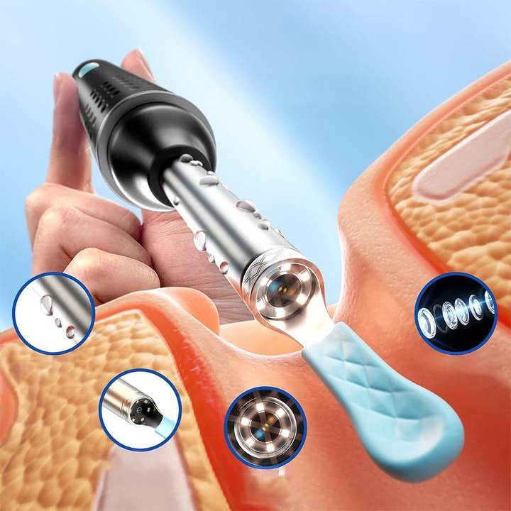 SMART OTOSKOP Z KAMERKĄ WIFI DO CZYSZCZENIA USZU NARZĘDZIA ZESTAW ENDOSKOP