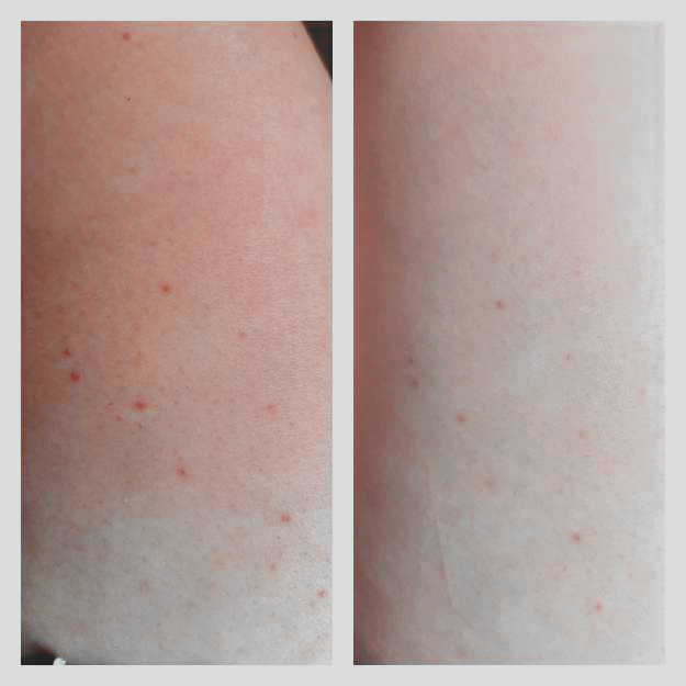 Ag+ Preparat po depilacji MIEJSC INTYMNYCH 100ml