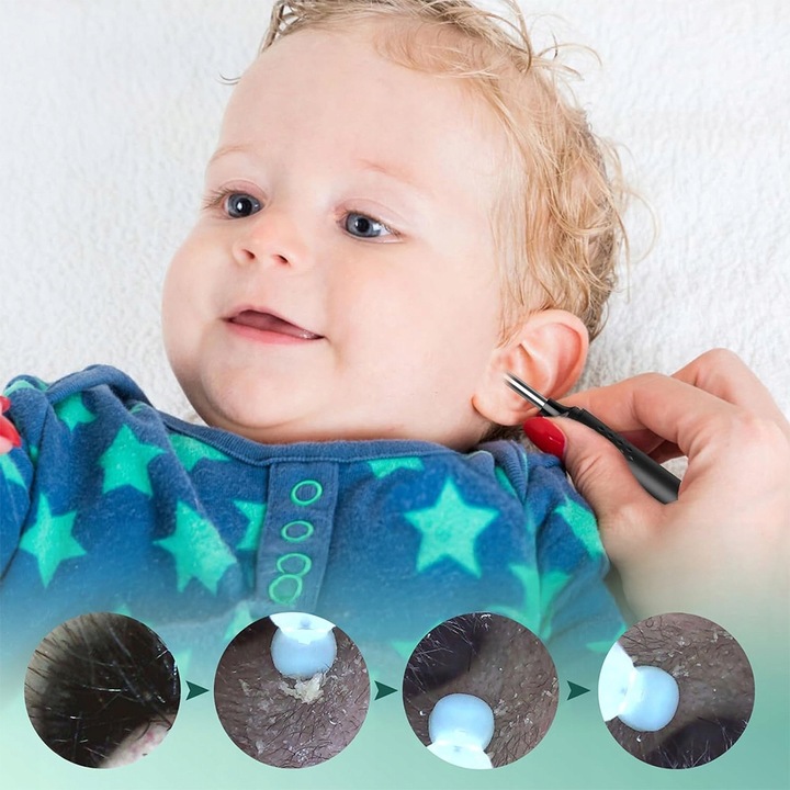 SMART OTOSKOP Z KAMERKĄ WIFI DO CZYSZCZENIA USZU NARZĘDZIA ZESTAW ENDOSKOP