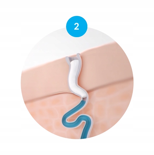 PERSPIREX Strong ANTYPERSPIRANT w kulce roll-on Dezodorant DERMO 20ml