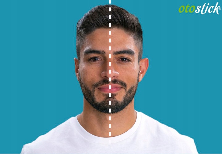 OTOSTICK Korektory Estetyczne Uszu 8szt + Waciki Oczyszczające Skórę