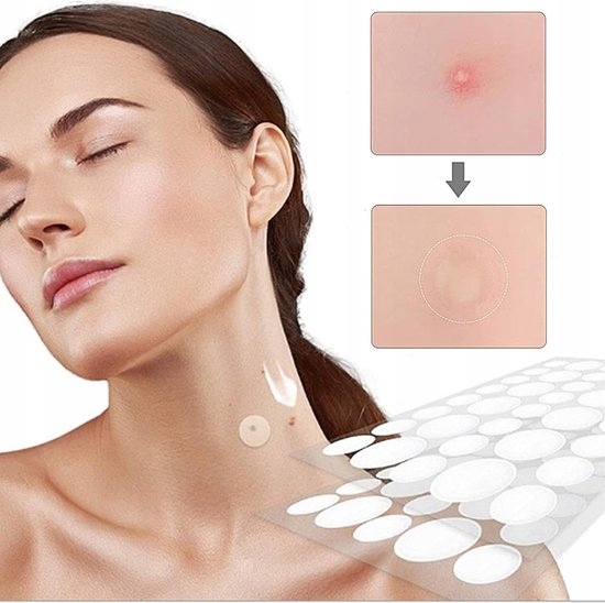 Plaster na Pryszcze trądzik do pryszczy Pimple Patches na Wypryski