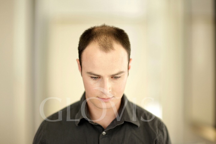 Włókna Mikrowłókna w Sprayu Wodoodporne Zagęszczanie Włosów Naturalny