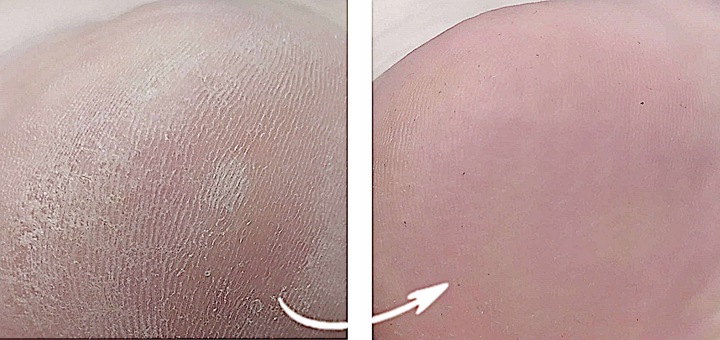 SPRAY NA GRZYBICĘ PAZNOKCI Z JONAMI SREBRA 100ml