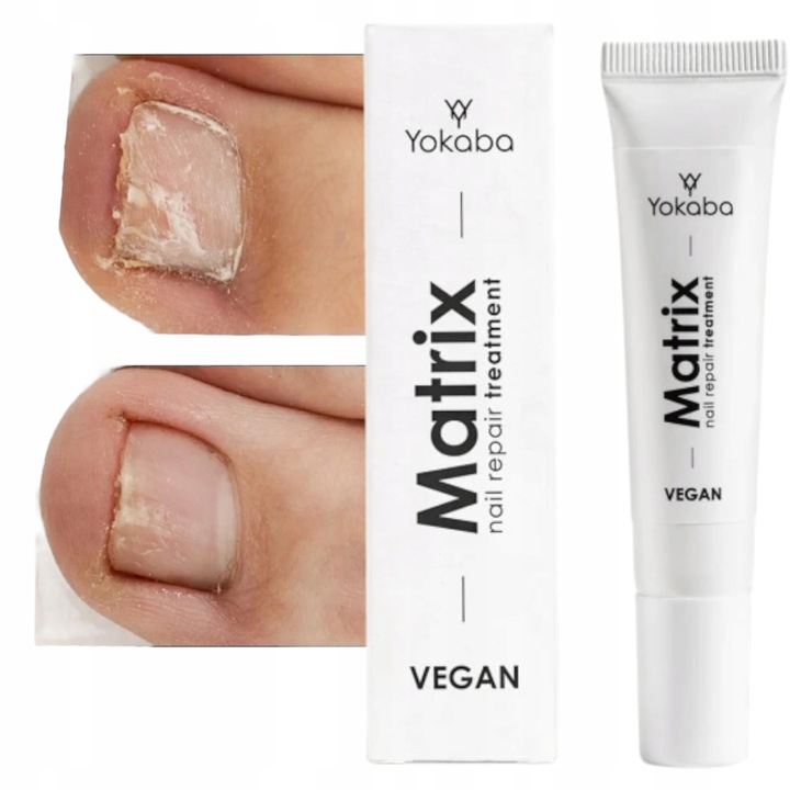 Yokaba MATRIX Preparat do regeneracji macierzy paznokcia 15 ml