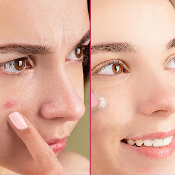 COSRX Acne Pimple Master Patch Plasterki na wypryski -72sztuk