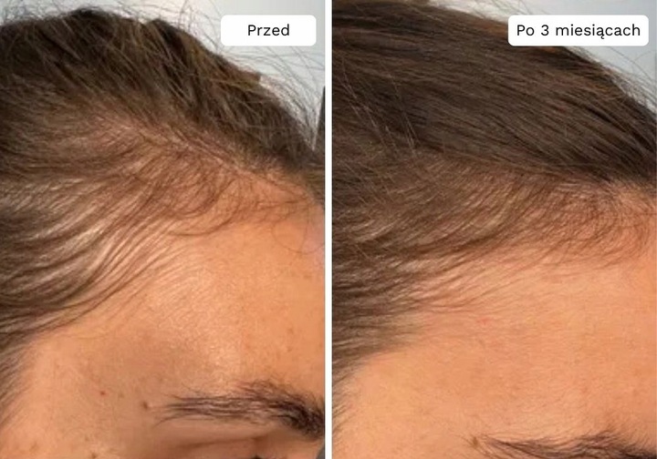 Wcierka Serum na porost i wypadanie włosów wzmacnia cebulki - Lavress 10w1